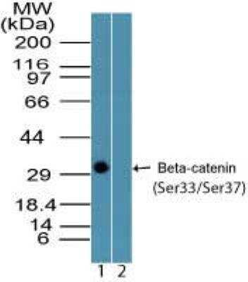 Western Blot: beta-Catenin [p Ser33, p Ser37] Antibody [NBP2-24456]